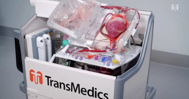 วิเคราะห์ TransMedics Group, Inc. (TMDX)